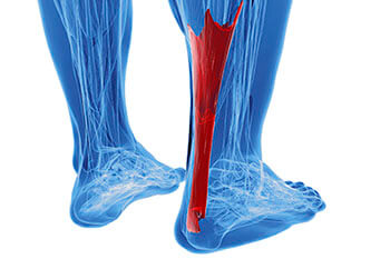 achilles tendonitis treatment in the Wayne, Paramus, Clifton, Montclair, Randolph and Edison, NJ area