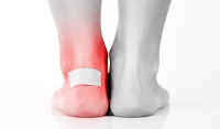 Medical Reasons Blisters May Develop on the Feet